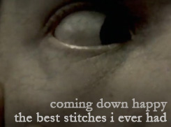The Funpowder Plot Presents Coming Down Happy - The Best Stiches I Ever Had